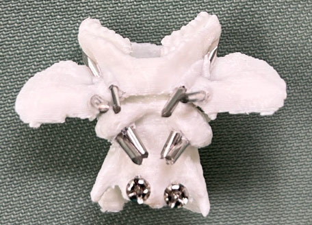 環椎軸椎不安定症罹患犬の3Dモデルを使用した術前計画