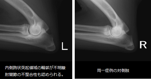 レントゲン検査