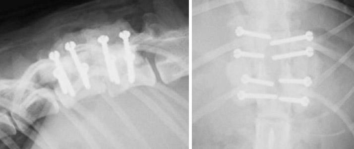 T12-13椎間の亜脱臼症例の術後X線検査 写真